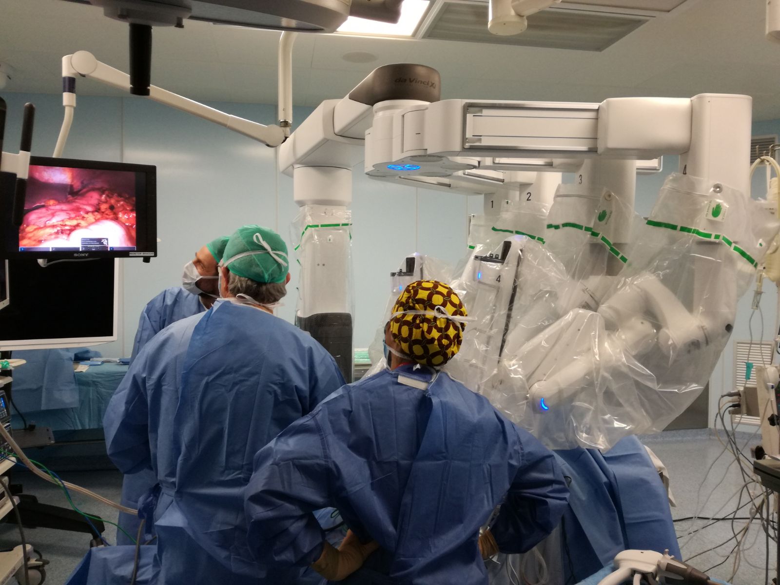Ospedale di Terni: arriva il sistema robotico di ultima generazione “Da Vinci Xi”